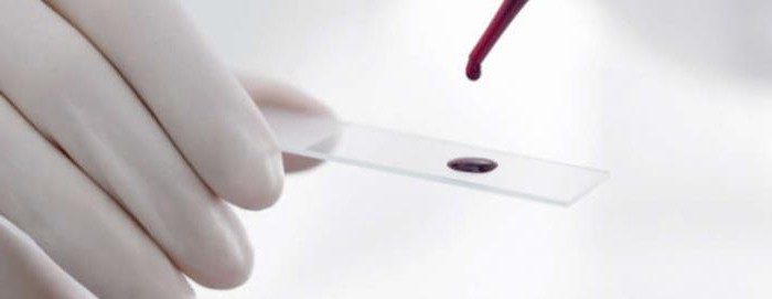 生化学的血液検査デコード